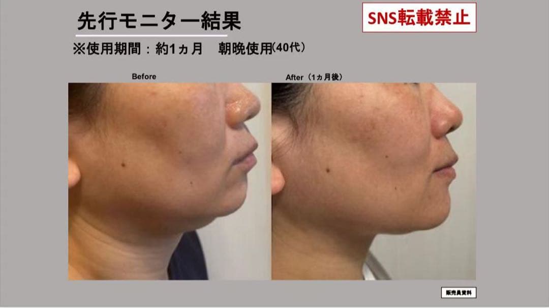 新品ナリスセルグレースフォーミュラI・II セット*3最高峰エイジング即効ハリ艶