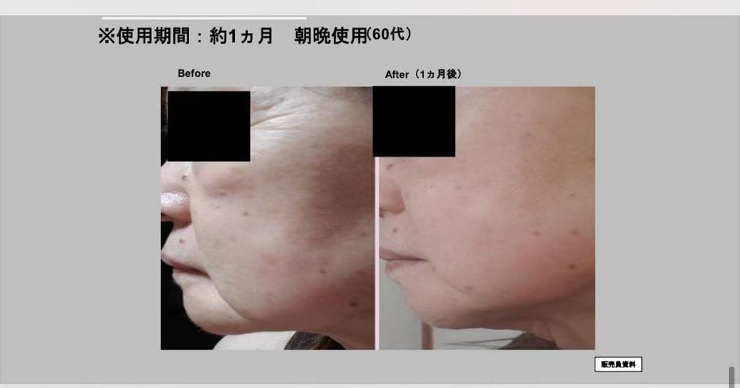 新品ナリスセルグレースフォーミュラI・II セット*3最高峰エイジング即効ハリ艶