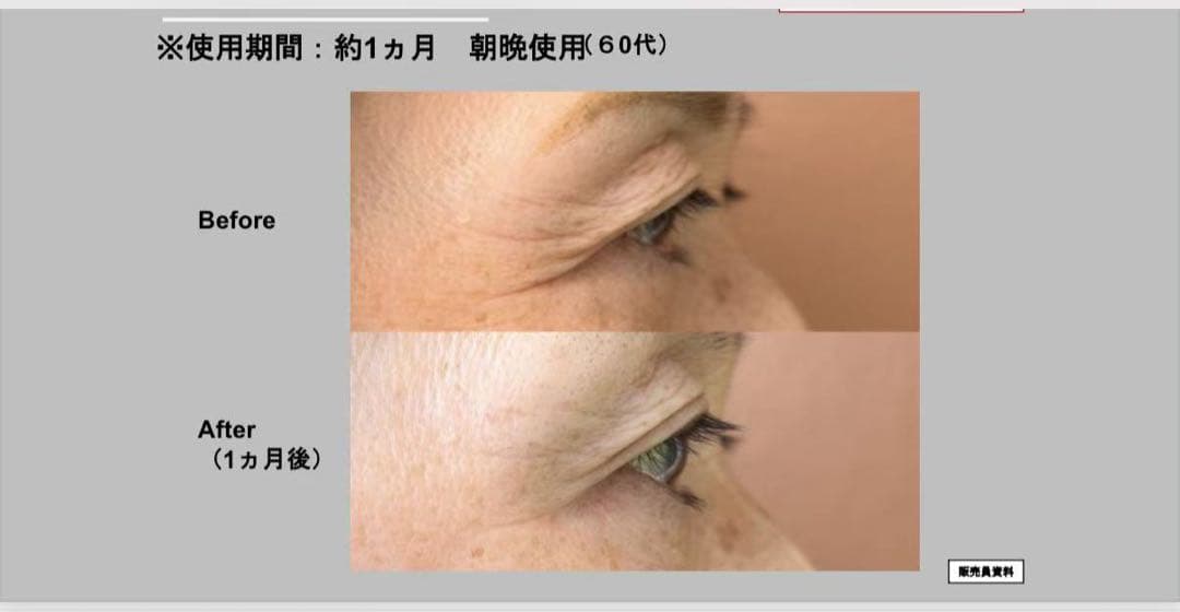 新品ナリスセルグレースフォーミュラI・II セット*3最高峰エイジング即効ハリ艶