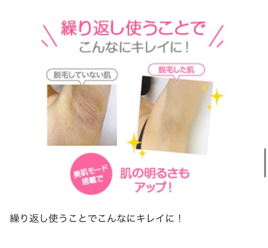 脱毛ラボホームエディション　脱毛転写回数30万回