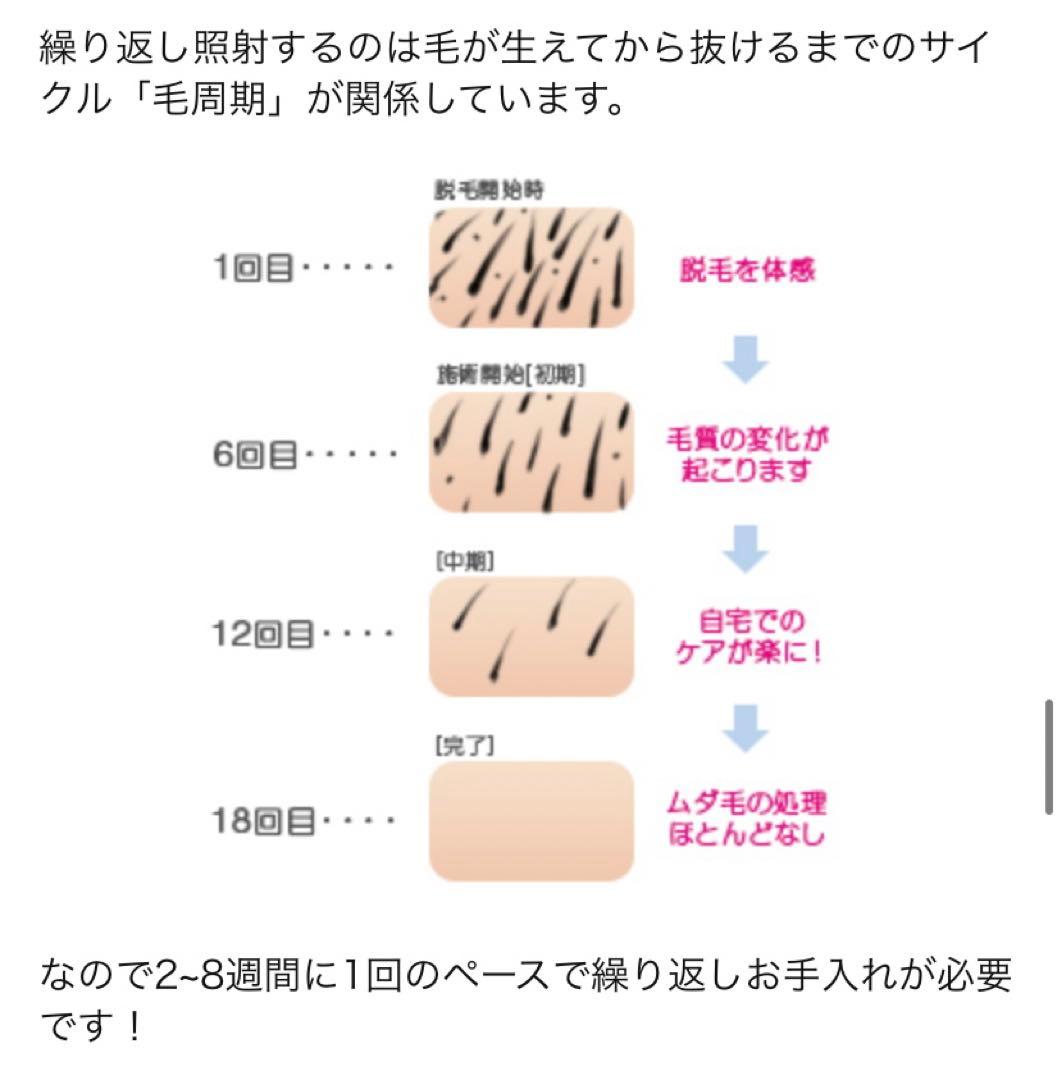 脱毛ラボホームエディション　脱毛転写回数30万回