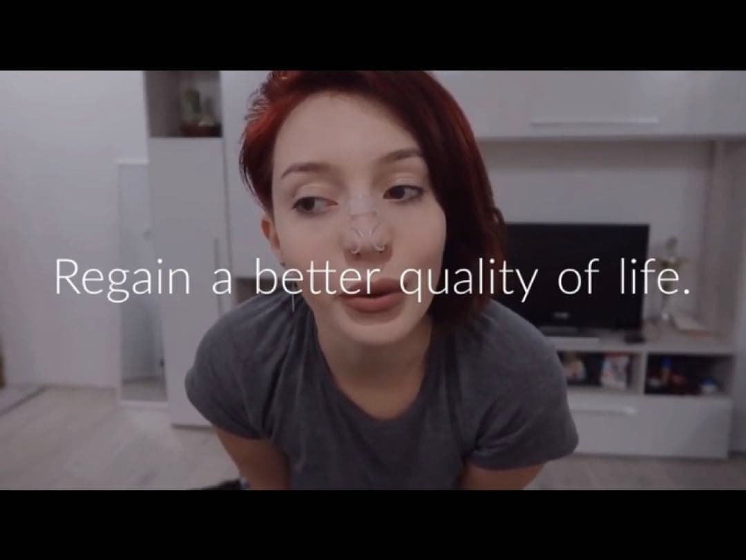 noson 鼻腔拡張器