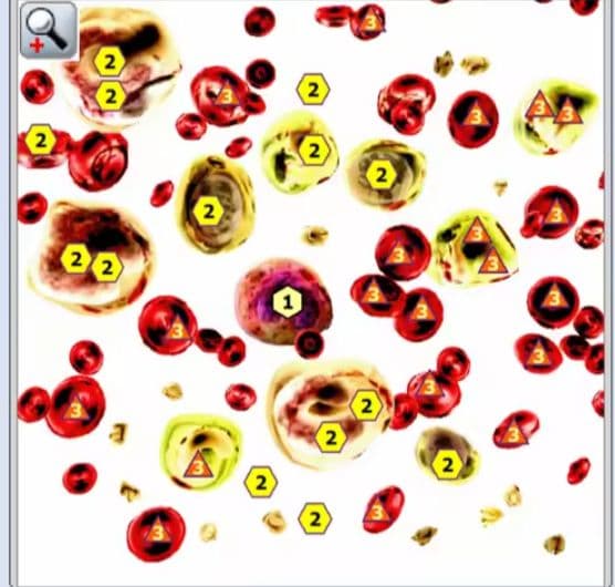 期間限定セール★波動測定器18D NLS メタトロン ニュースキャンヒーリング