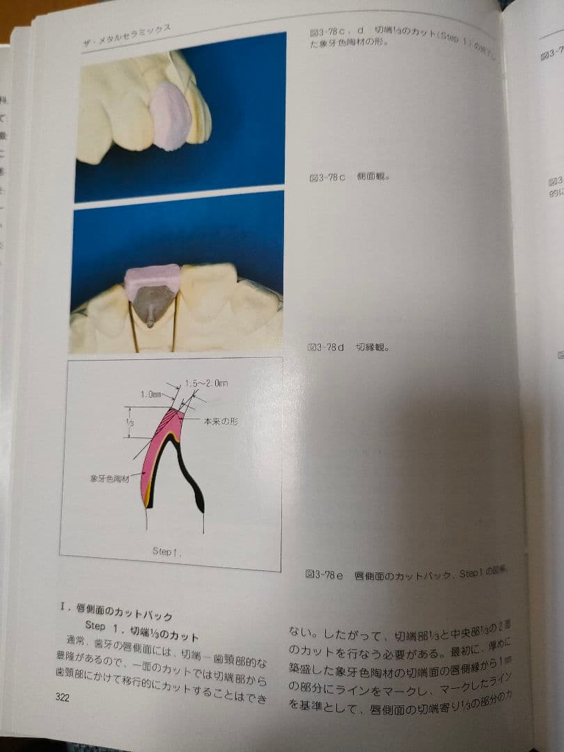 ザ・メタルセラミックス　歯科技工　歯科