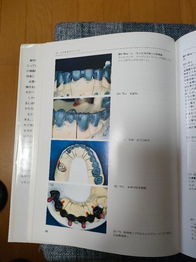 ザ・メタルセラミックス　歯科技工　歯科