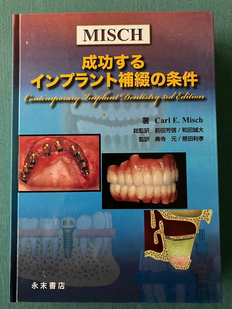 成功するインプラント補綴の条件