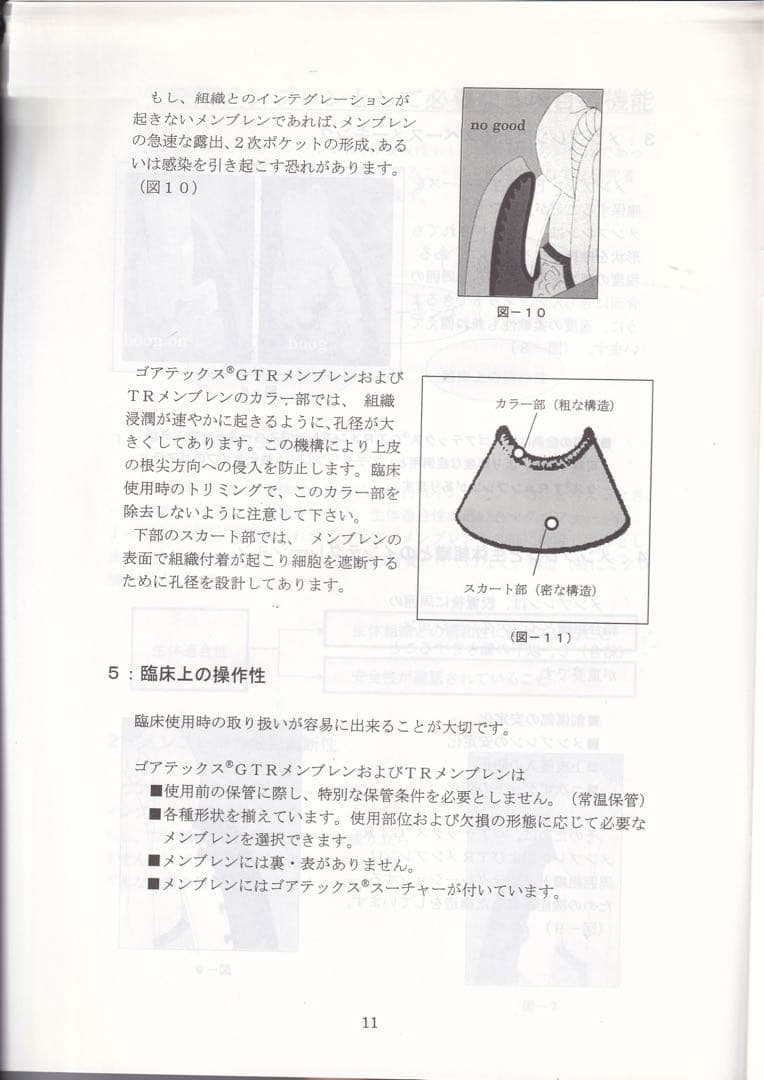 ゴアテックス　メンブレン　レジメ #歯科　　#インプラント