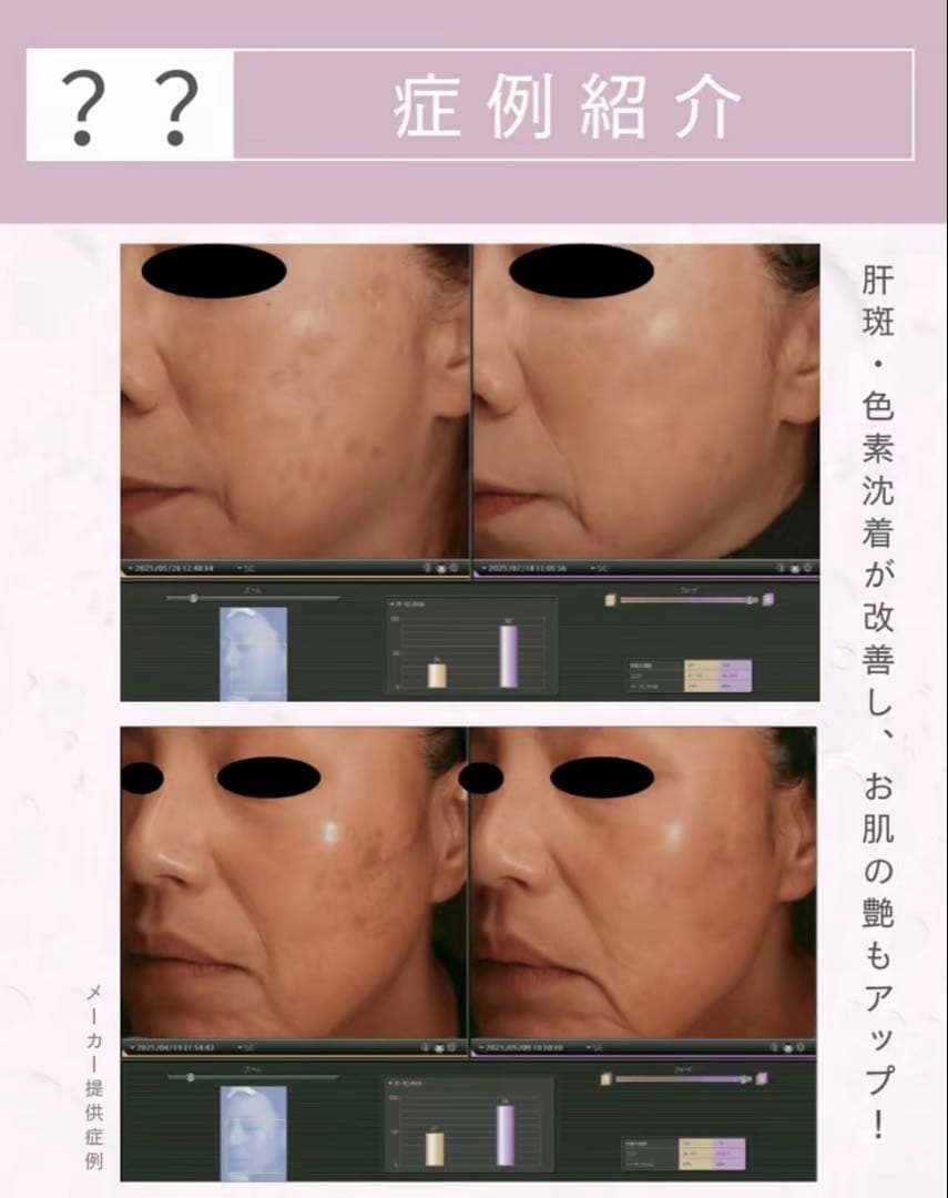 rrrmm　ピンクグロー２本