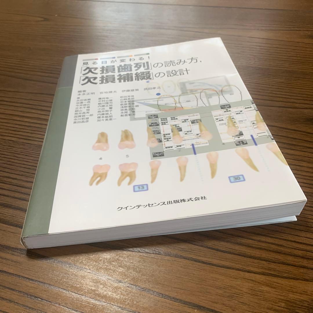 見る目が変わる!「欠損歯列」の読み方,「欠損補綴」の設計