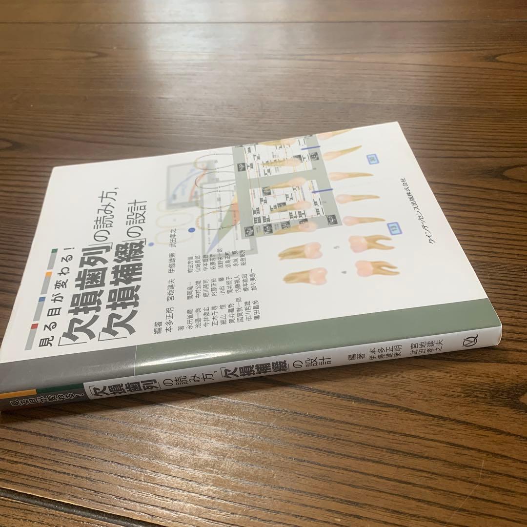 見る目が変わる!「欠損歯列」の読み方,「欠損補綴」の設計