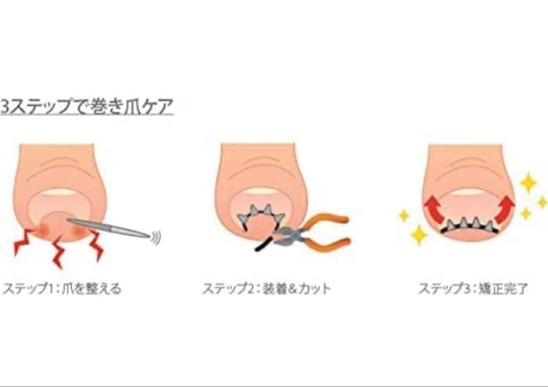 まき爪リフト　4個セット【正規品】