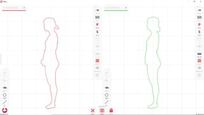 Styku S100システム　 3Dボディスキャナー