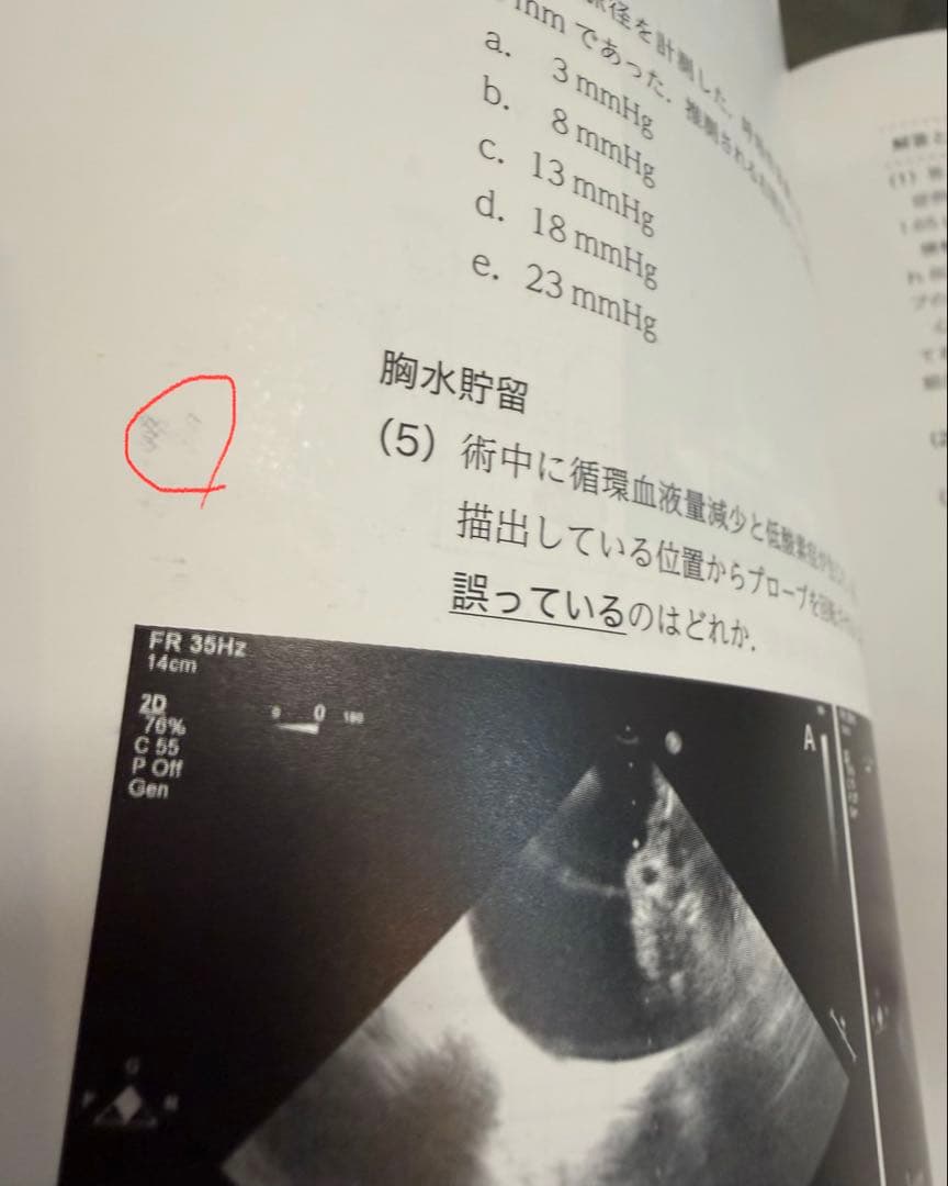 中外医学社 TEE試験対策ガイド JB POT 心エコー図専門医試験徹底攻略