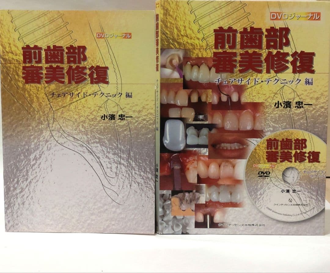 前歯部審美修復 チェアサイド・テクニック編 小濱忠一 歯科 治療 DVD 本