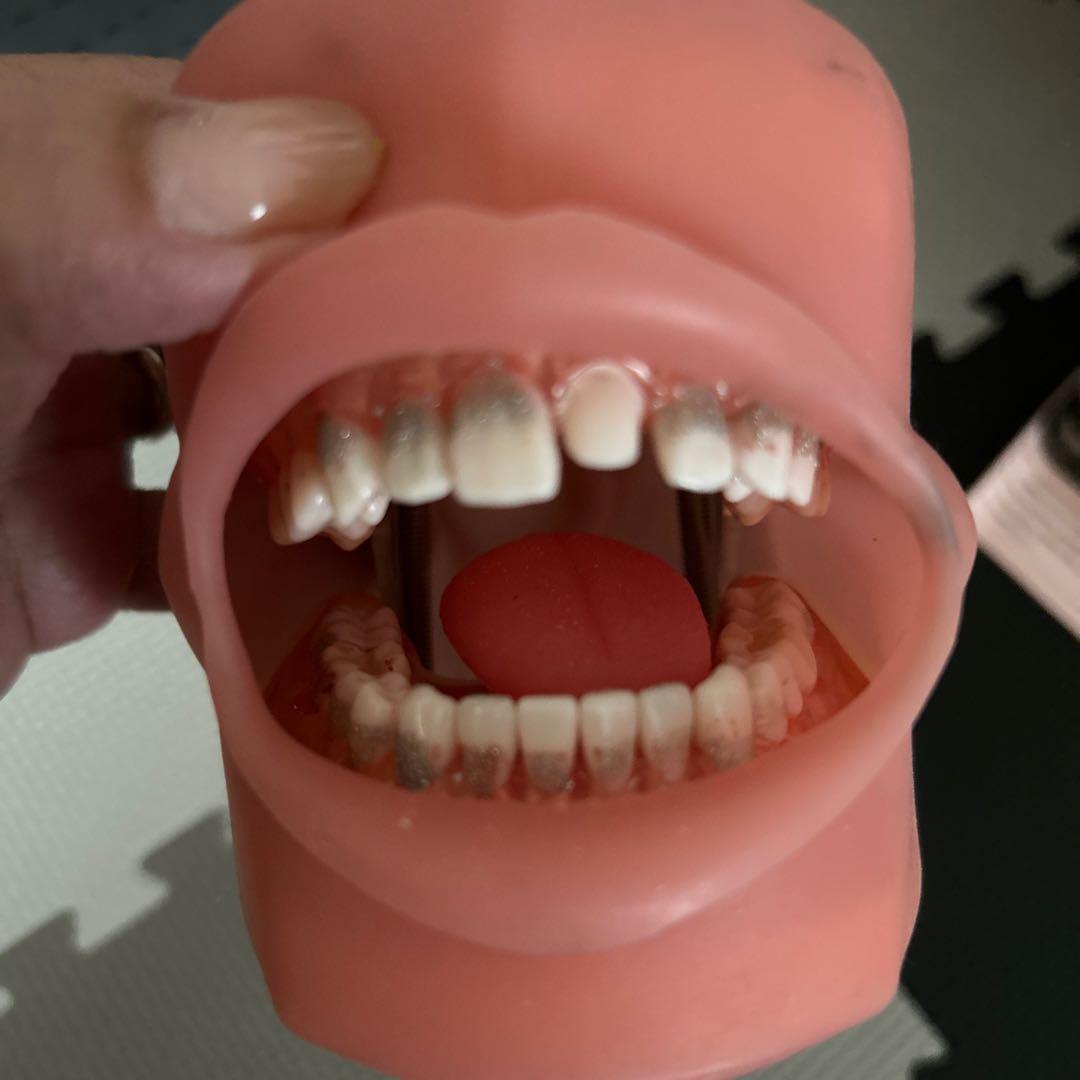 NISSIN歯の模型と、頬粘膜ボックスフルカバー SPMIII