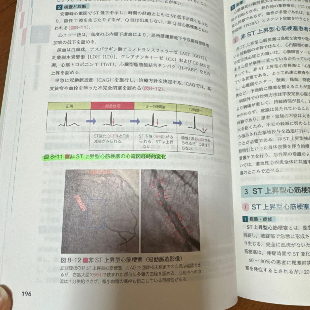 ナーシング・グラフィカEX 疾患と看護 ①〜⑨