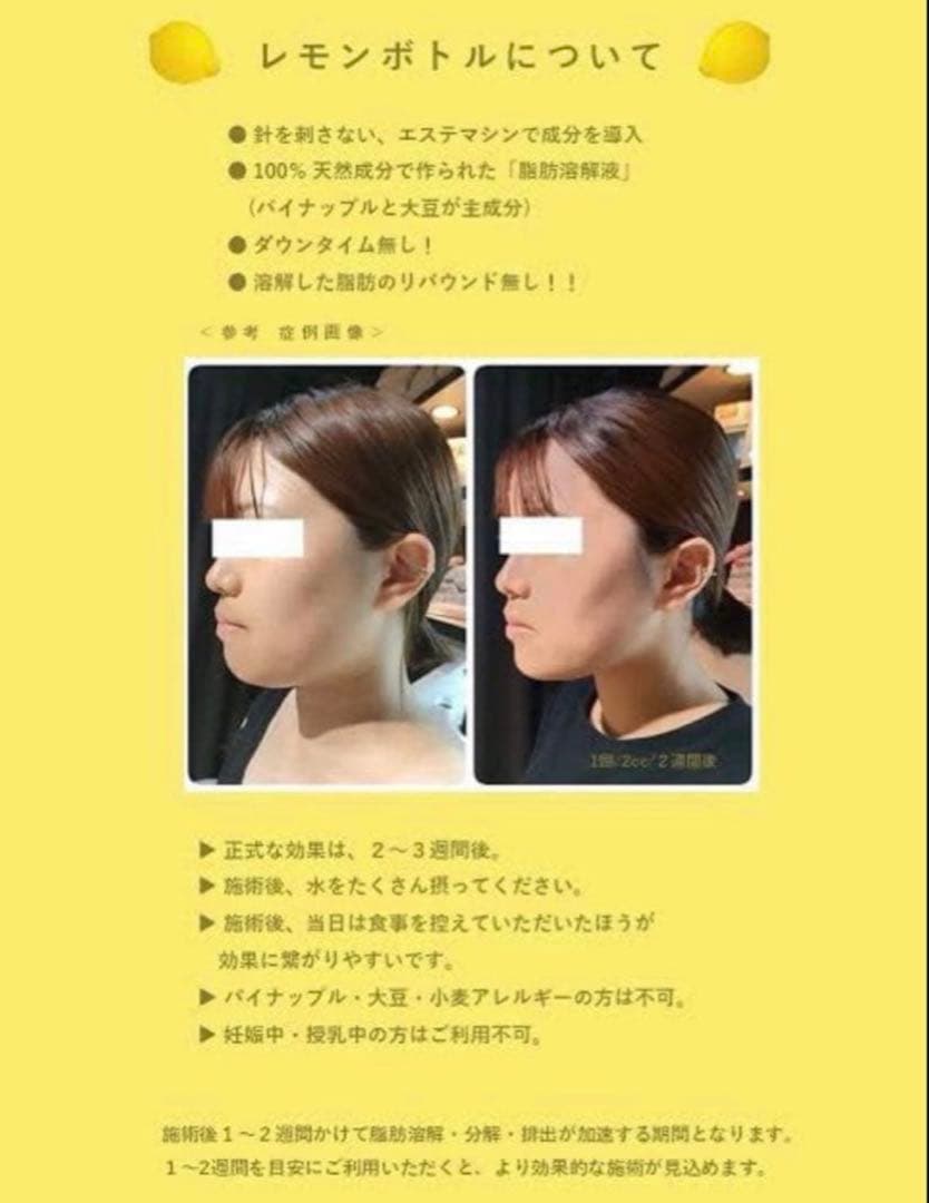 s　レモンボトル3本