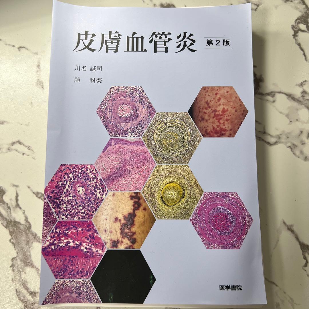 【裁断済み】皮膚血管炎