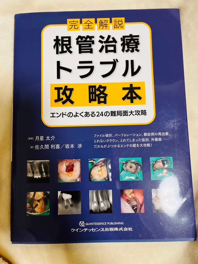 根管治療トラブル攻略本