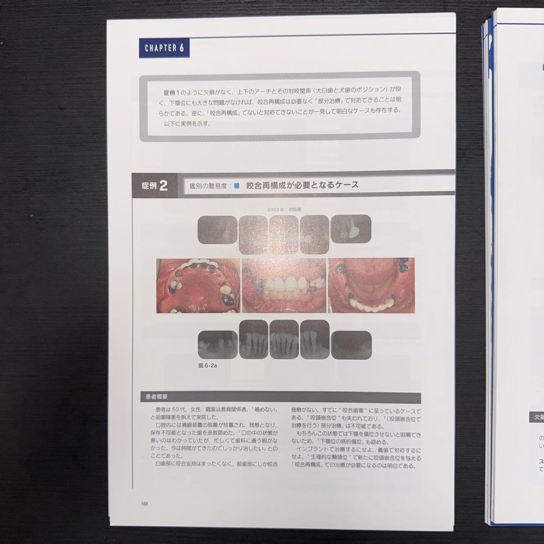 健康・医学 Restorative Design & Practical Occlusion