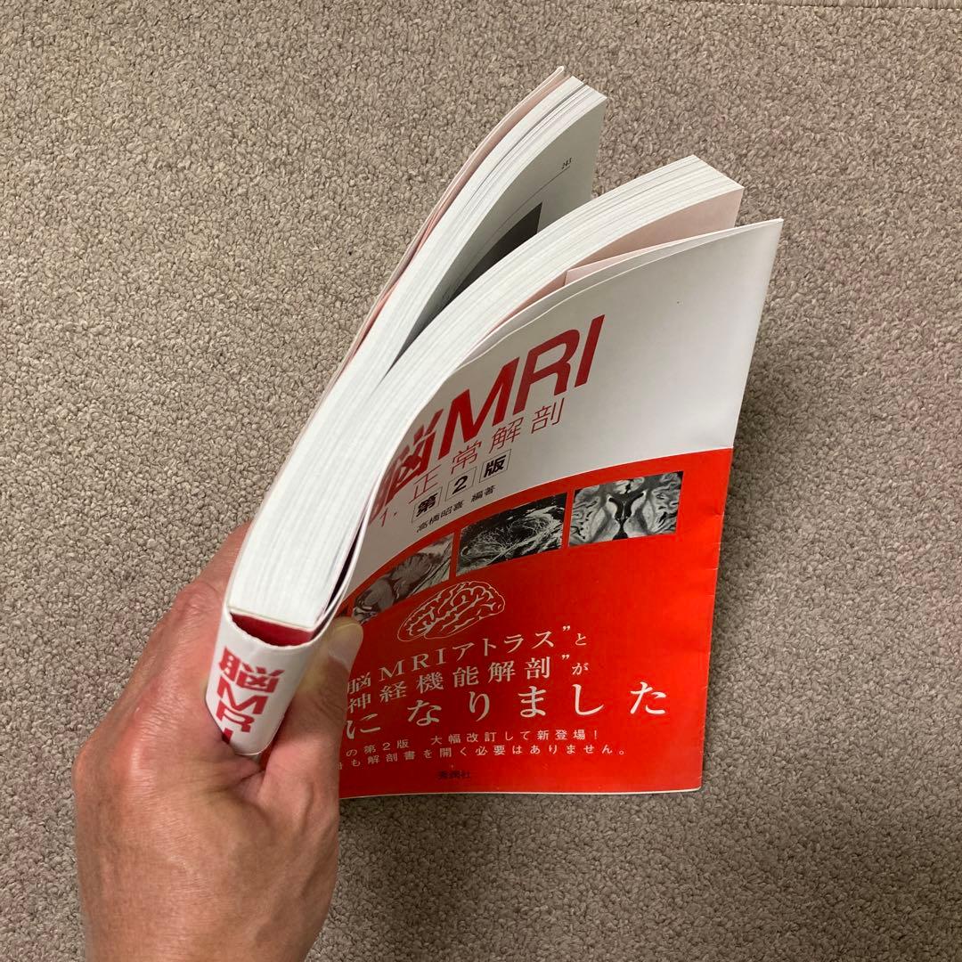 脳MRI 1(正常解剖)