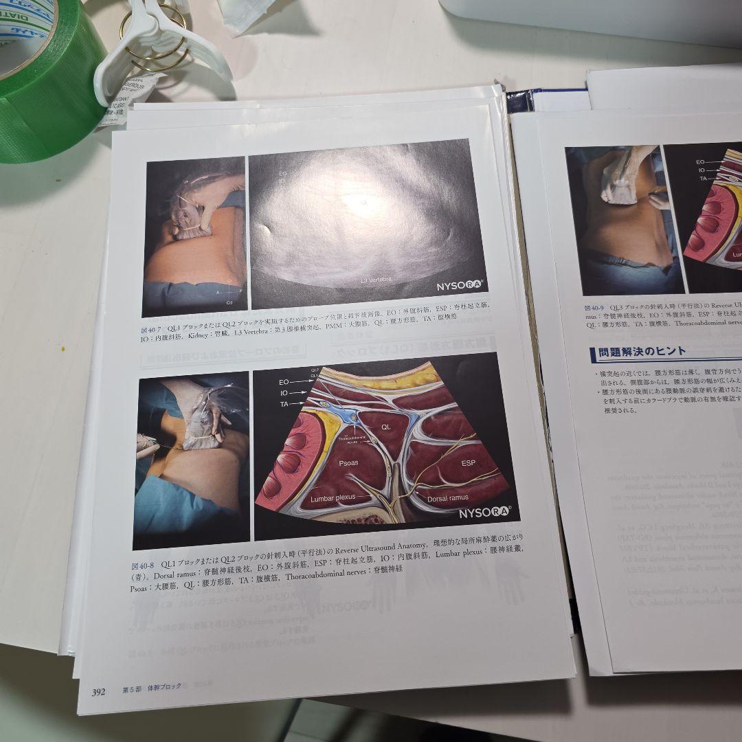 裁断済み　Hadzic's 超音波ガイド下末梢神経ブロックと解剖