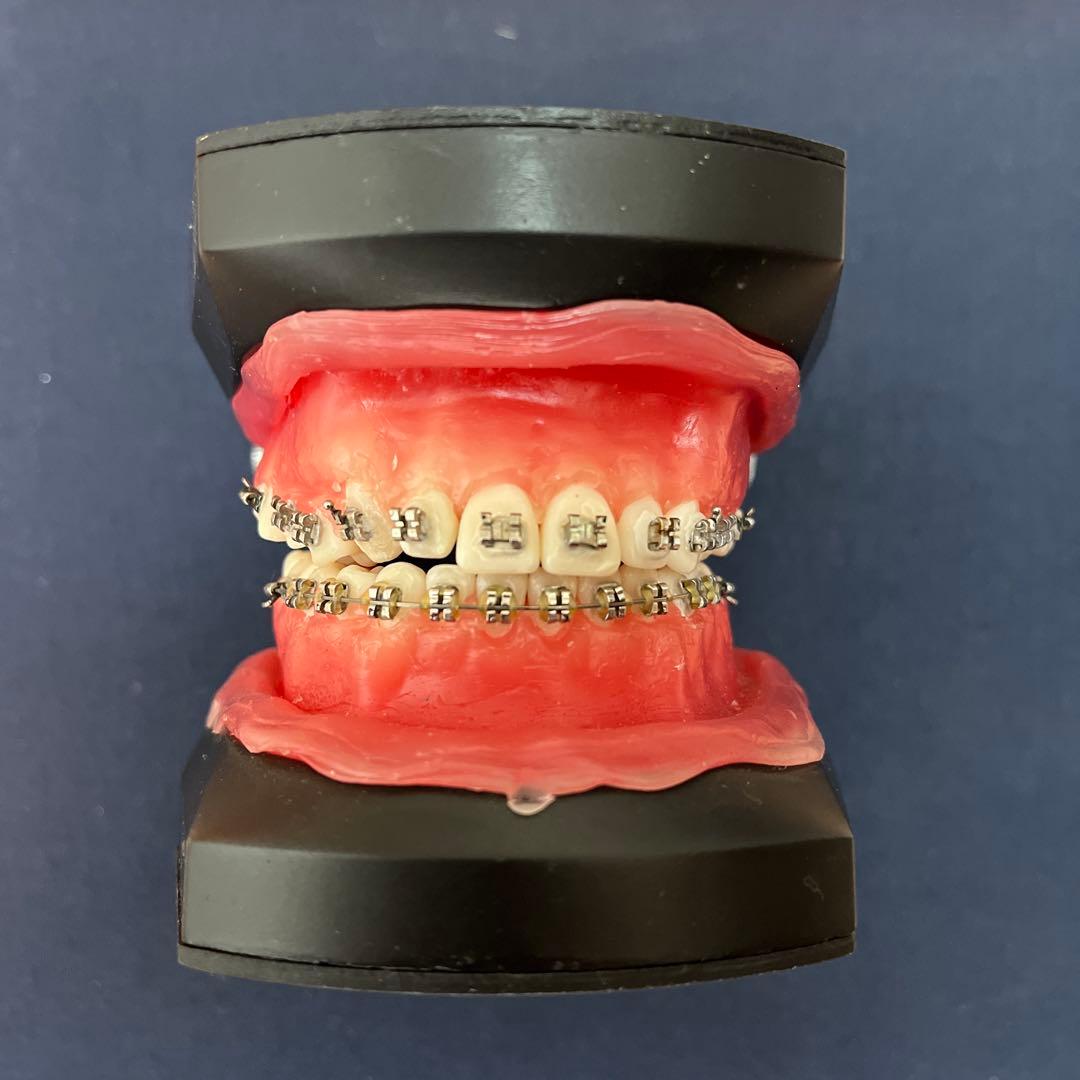 タアポドント咬合器　矯正装置付き