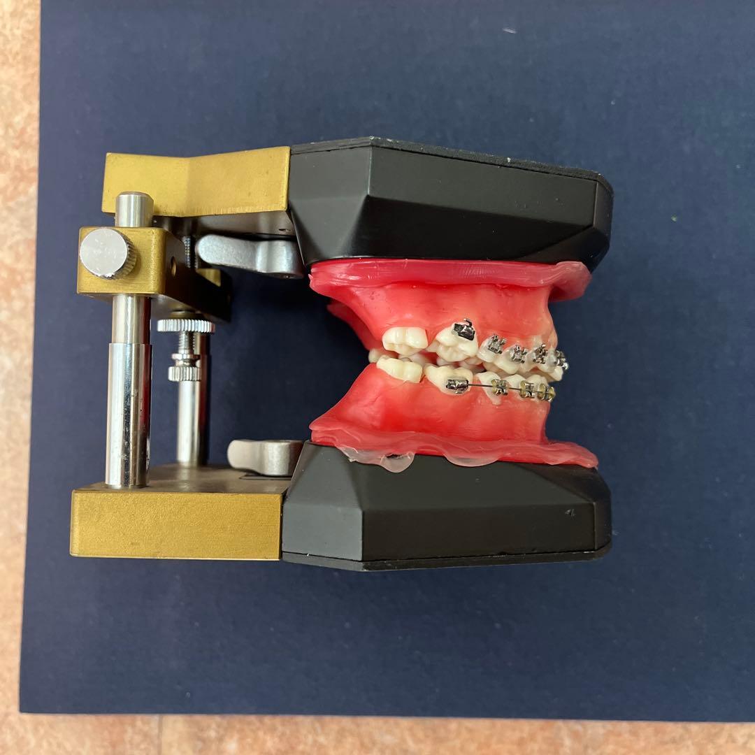 タアポドント咬合器　矯正装置付き