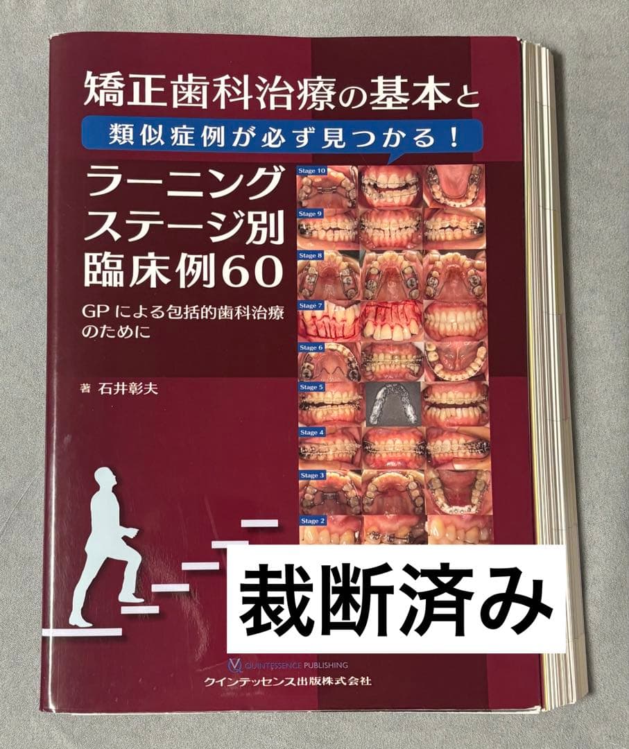 矯正歯科治療の基本と類似症例が必ず見つかる!ラーニングステージ別臨床例60 :…