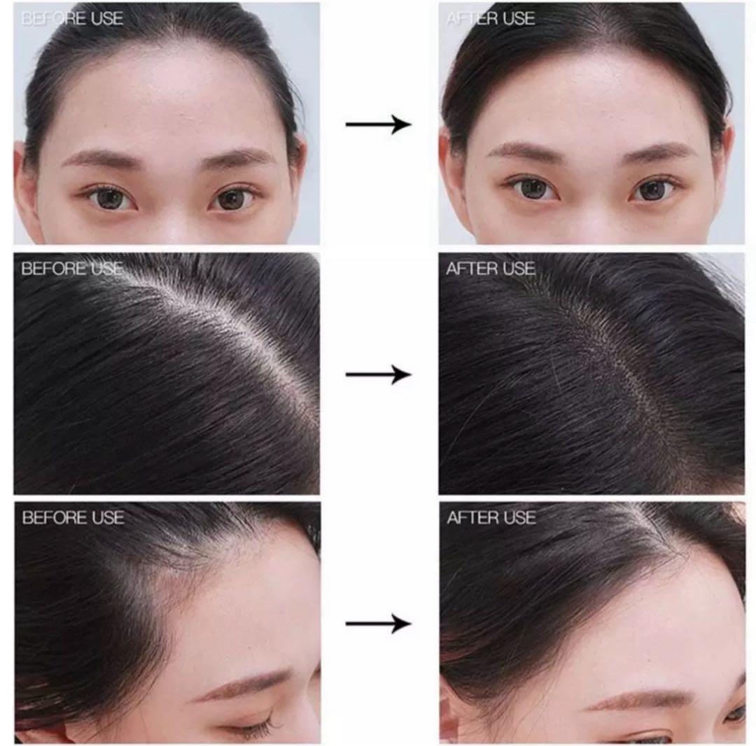 ブラック(ダークグレー)20個