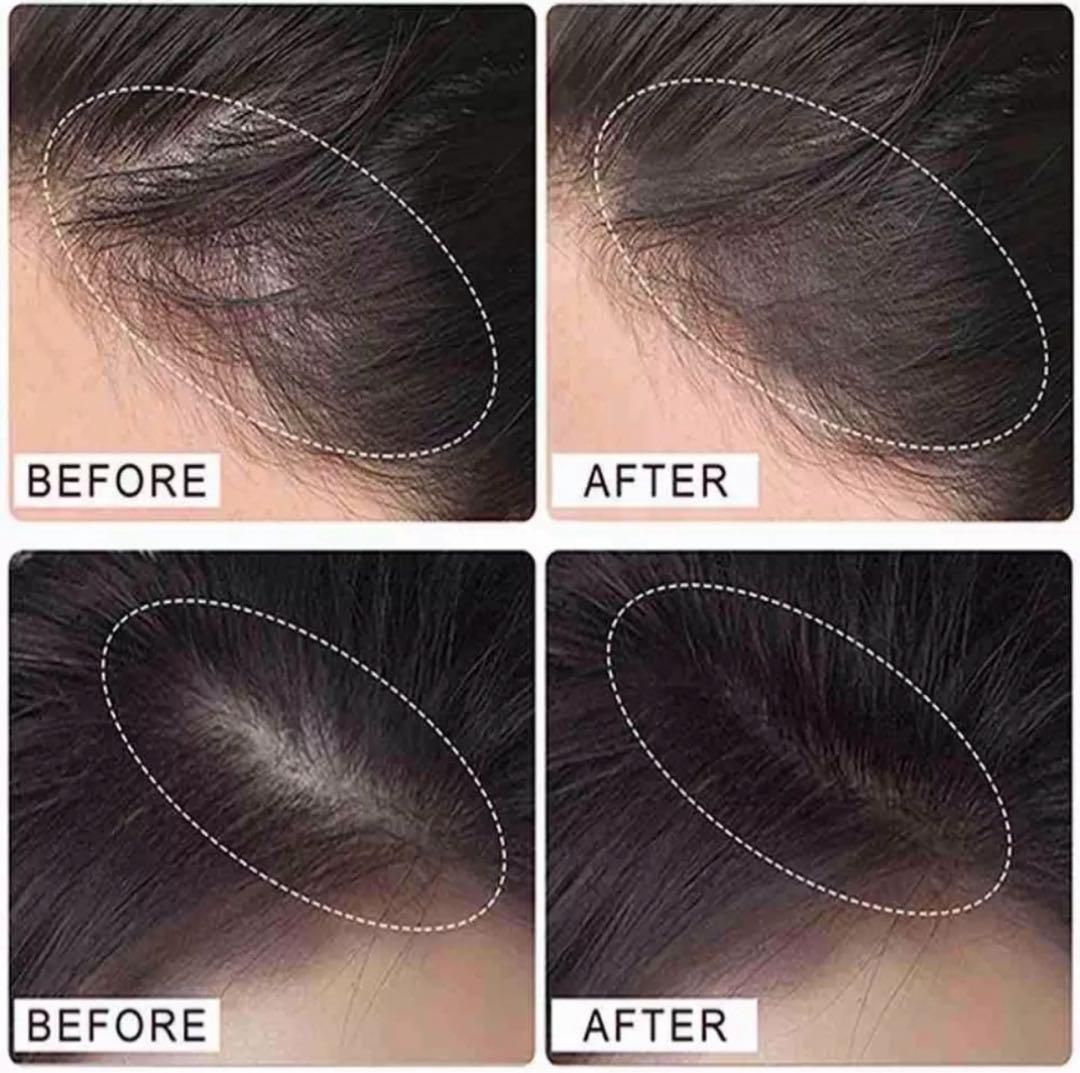 ブラック(ダークグレー)20個