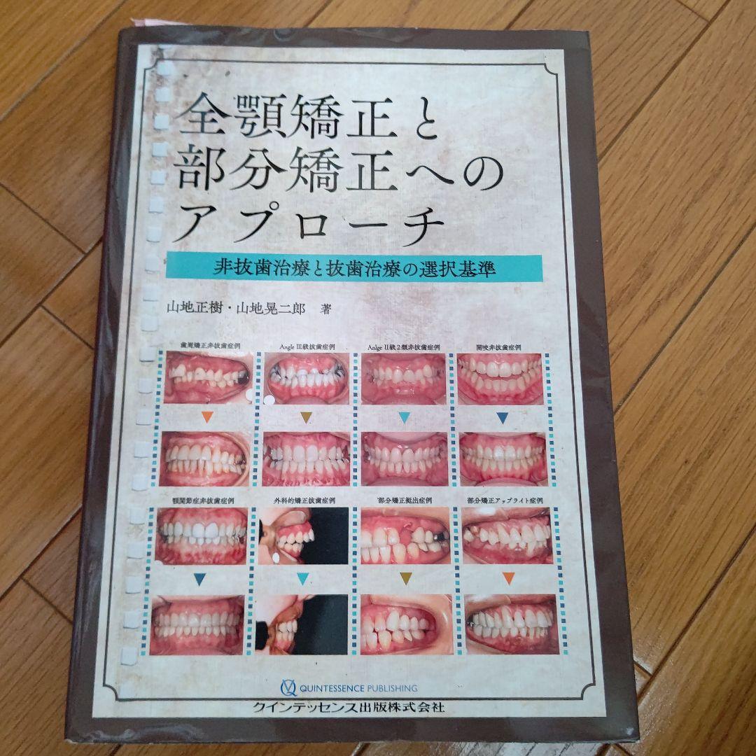 全顎矯正と部分矯正へのアプローチ : 非抜歯治療と抜歯治療の選択基準