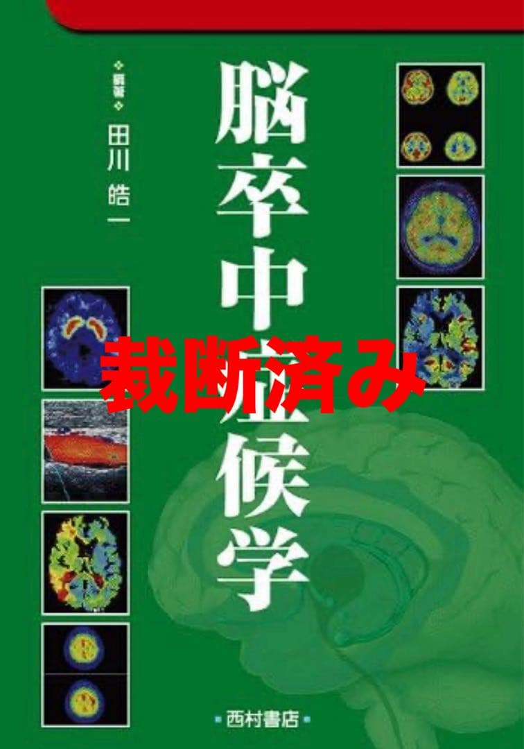 脳神経外科 脳卒中症候学
