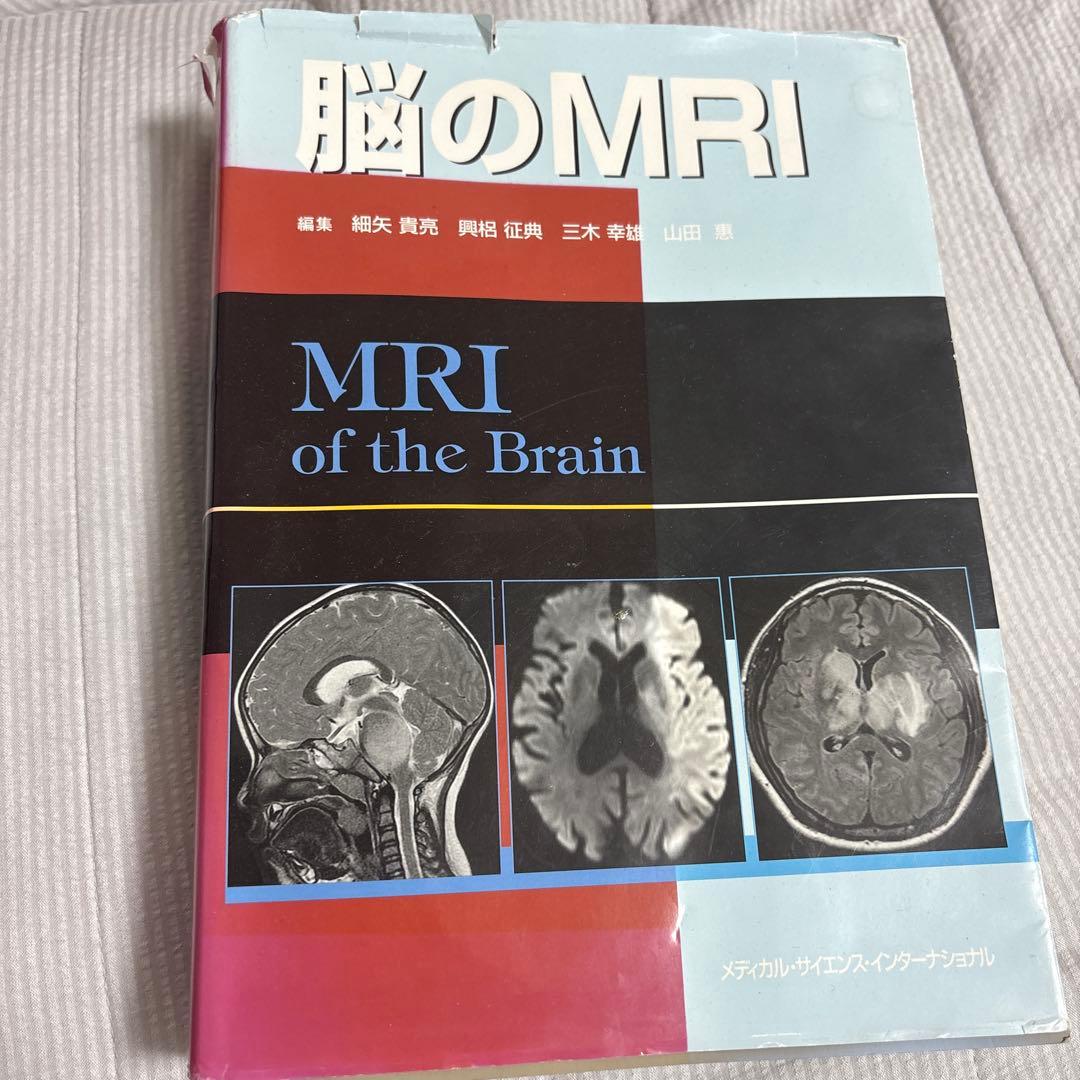 脳のMRI