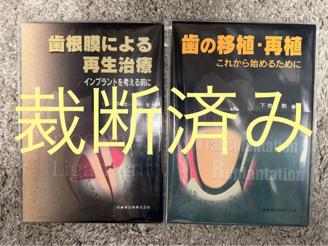 【裁断済み】歯の移植・再植、歯根膜による再生治療