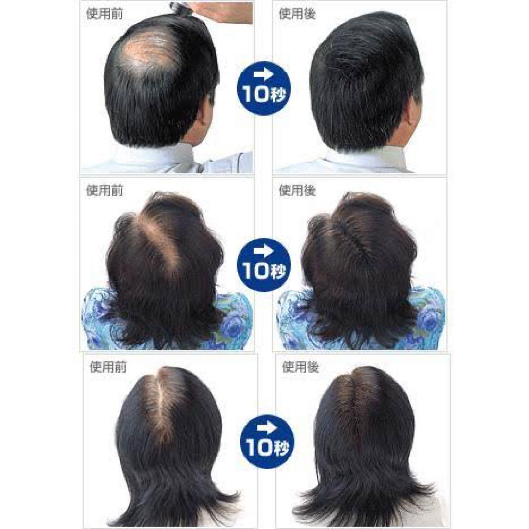 最安値10個セット 大容量40g ブラック NO.1 スーパーミリオンヘアー 黒