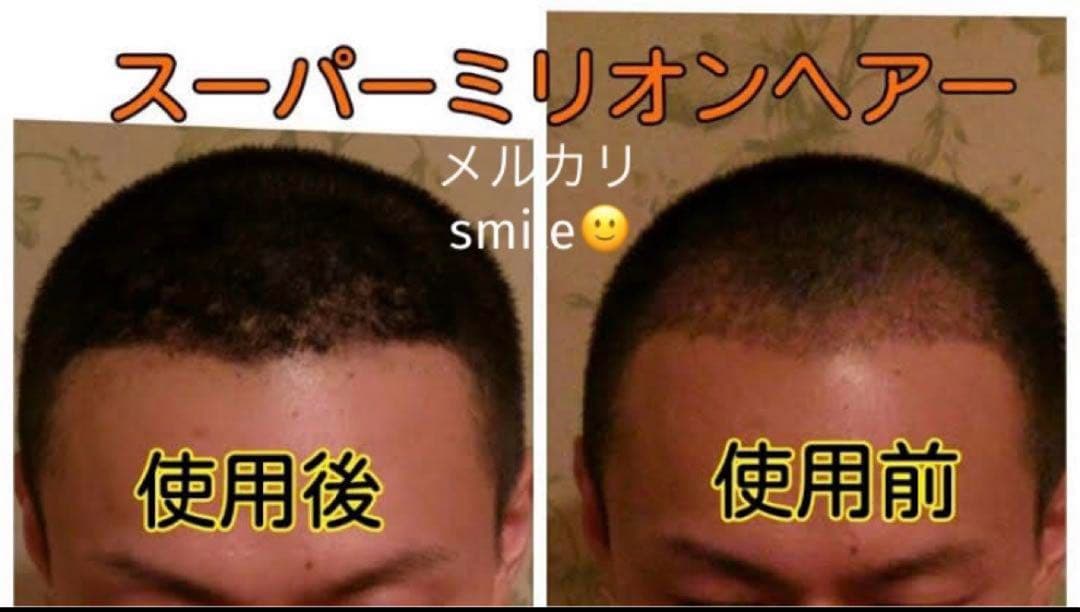 最安値10個セット 大容量40g ブラック NO.1 スーパーミリオンヘアー 黒