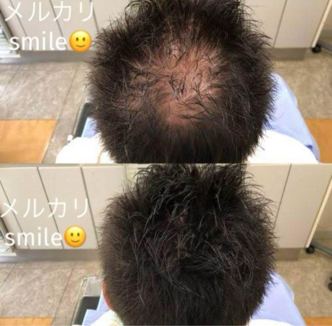 最安値10個セット 大容量40g ブラック NO.1 スーパーミリオンヘアー 黒