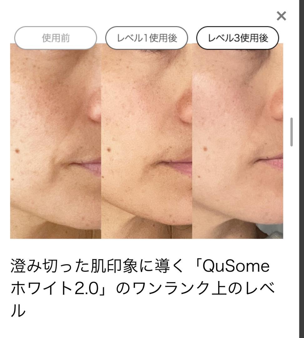 ビーグレンVC5・VA5・HQ5＋リセットマスク付。最高濃度レベル5の美容液