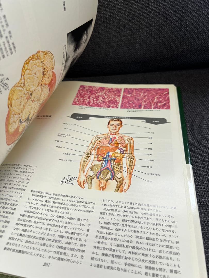 医学図譜集 腎臓編【Frank H. Netter 解剖学専門書 医学イラスト本