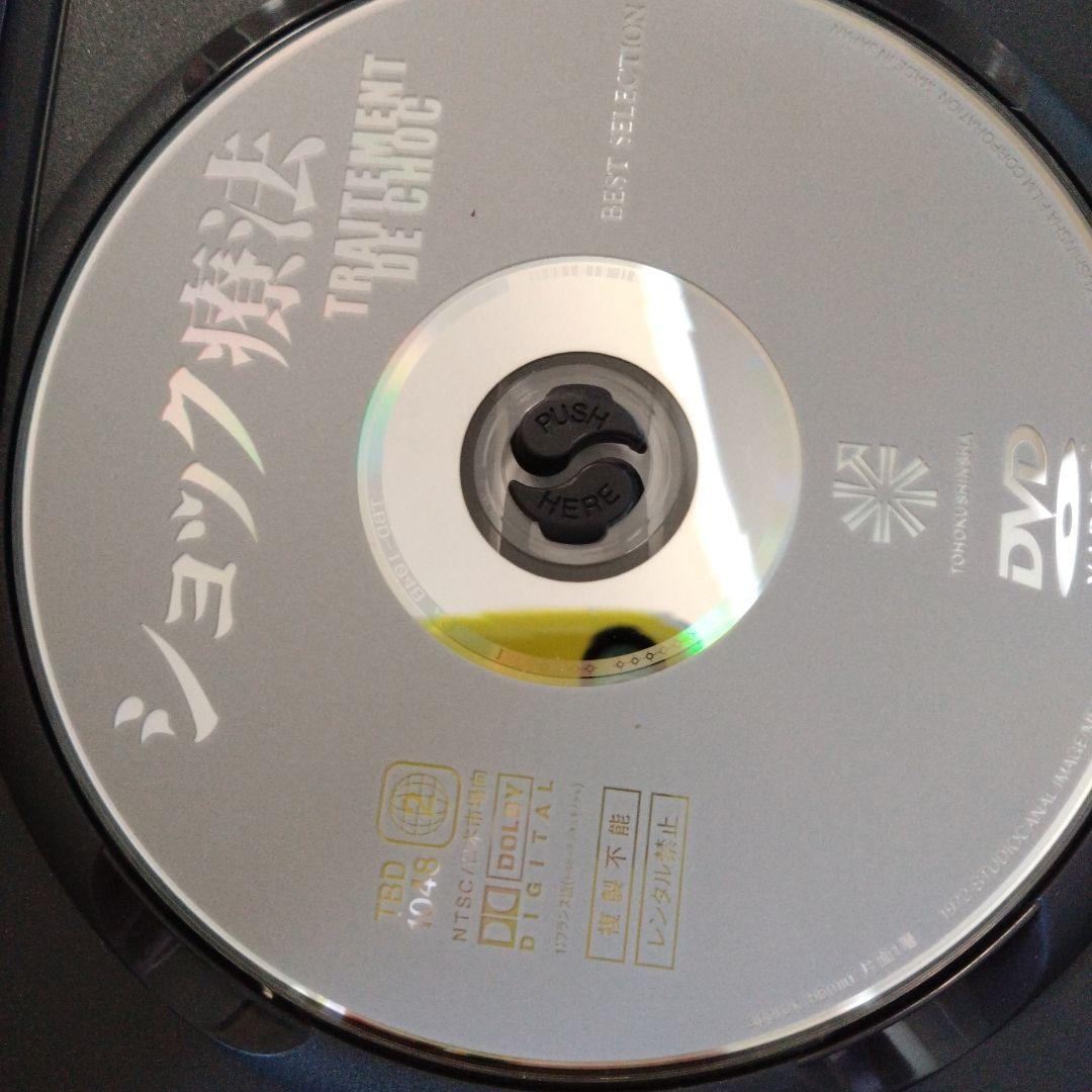 アラン・ドロン　ショック療法　DVD