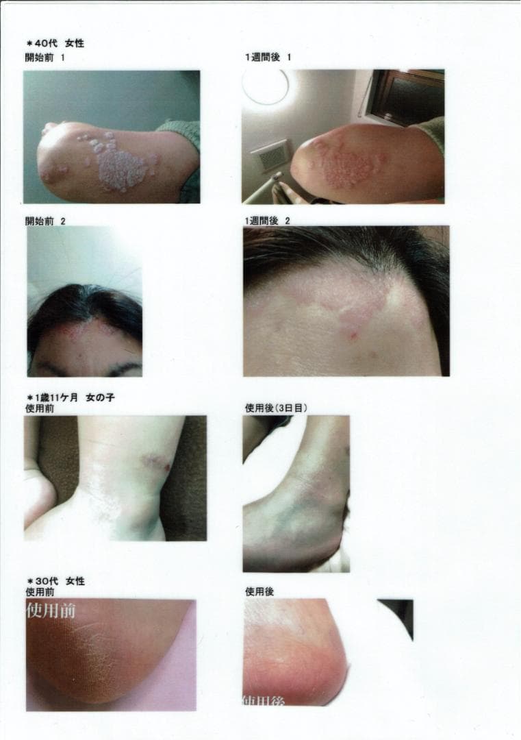 【新品3個】PharmaS1 ファルマS1 シコニンクリーム ノンステロイド