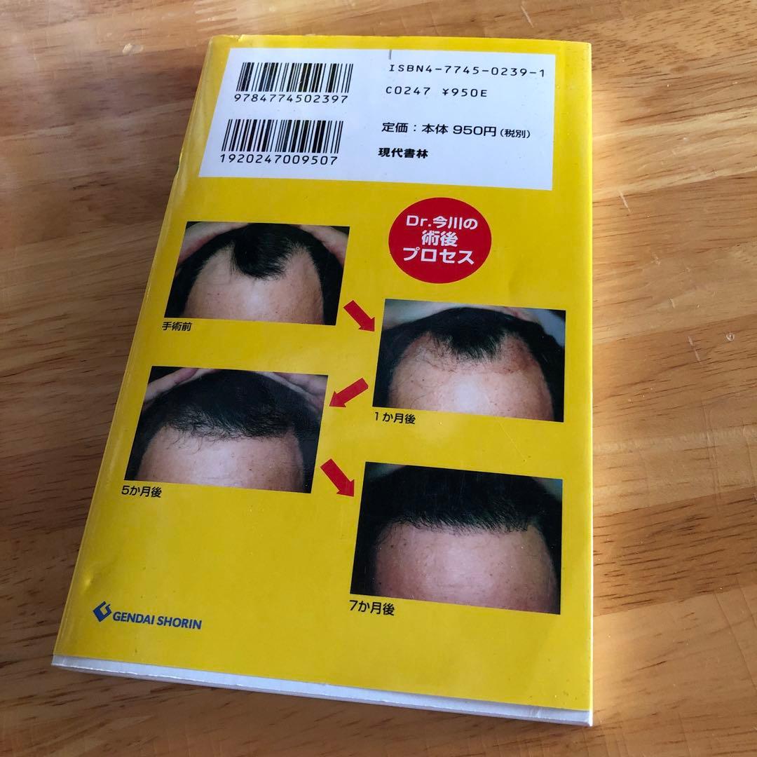 Dr.今川の植毛体験記 専門医が自分の髪で実践したドキュメント 最先端の自毛植…