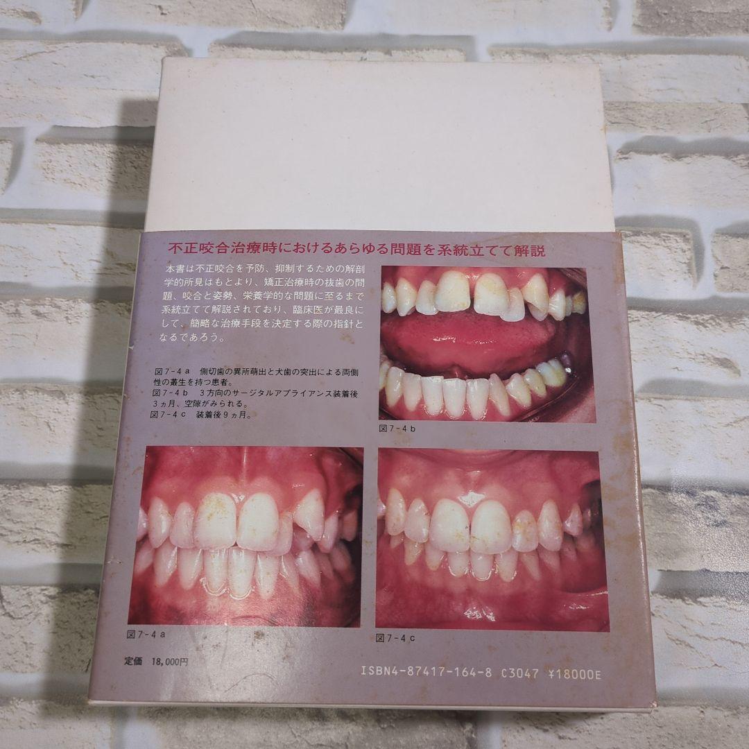 マキシロフェイシャル オーソペディックス 小児歯科矯正治療へのアプローチ