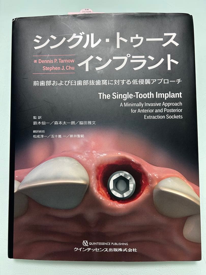 シングル・トゥース インプラント