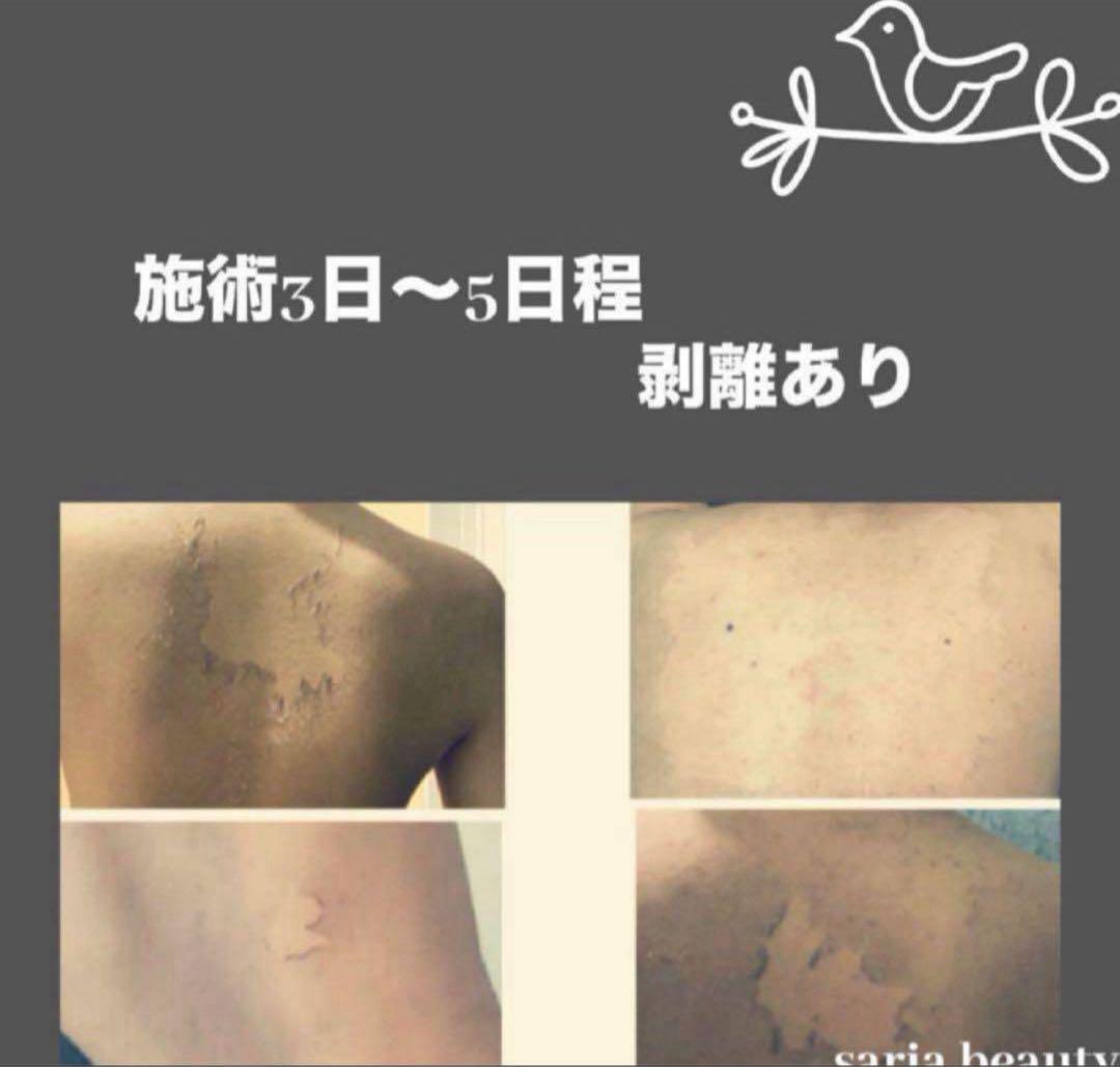 ハーブピーリング　剥離あり　オーガニック　CICA アロエベラ　ツボクサ