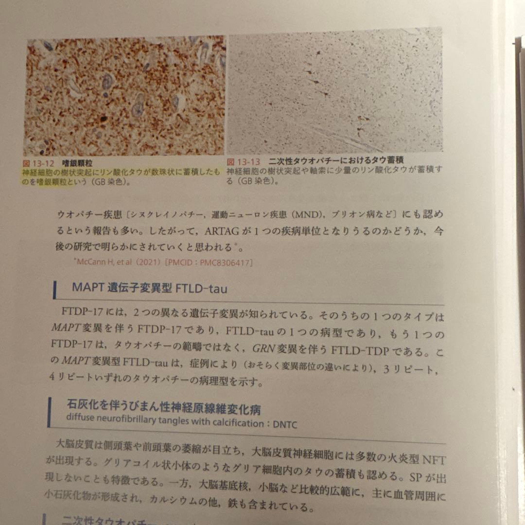 【裁断済み】神経病理インデックス第2版