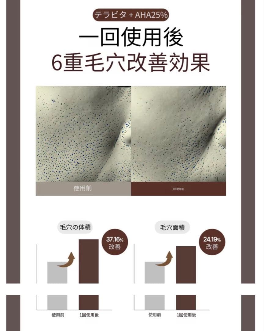 【新品】PAMSIBCテラフィル酸キット (4回分)(+エステ専用サンプル5種)