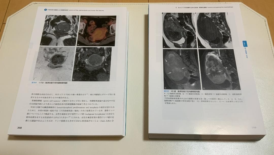 【裁断済】産婦人科の画像診断 第2版