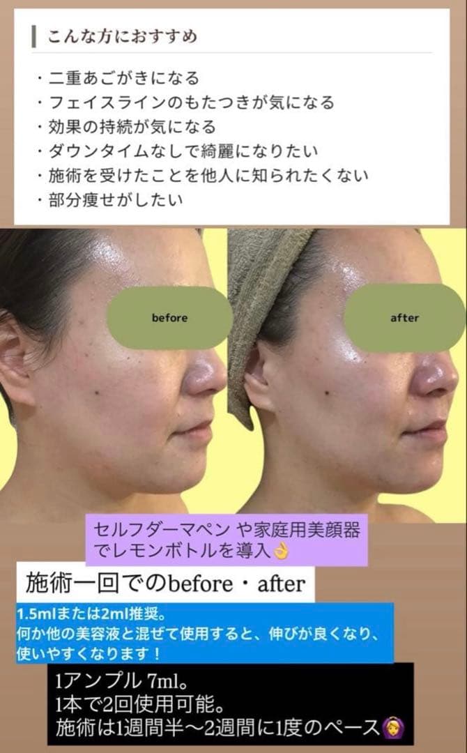 リヒラン　レモンボトル×3本